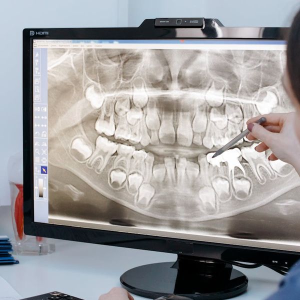 Abstract image of light rays focusing on a central point.